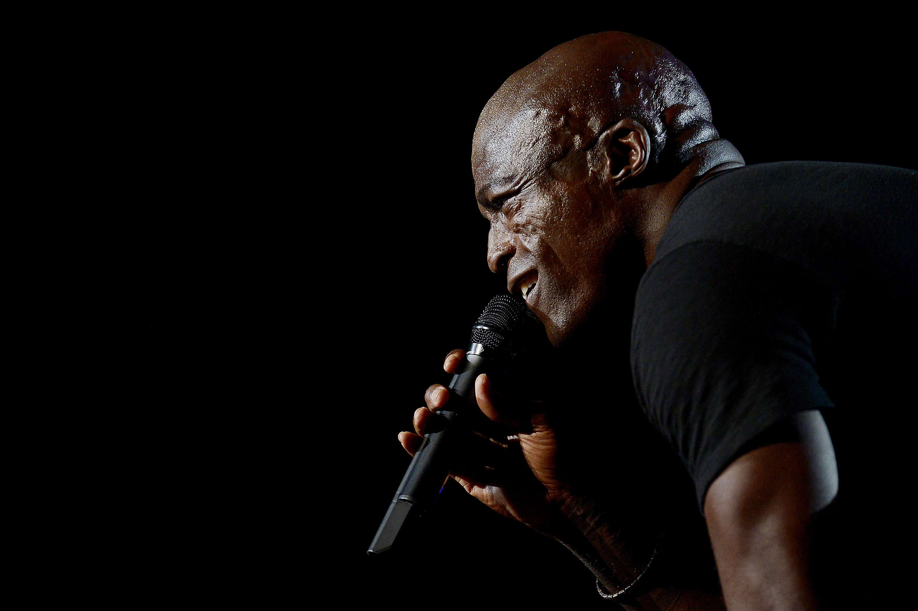 Musician Seal Face Scars, Seal Face Scarring, Discoid Lupus Erythematosus, What Happened to Seal's Face, Seal Face Scars Caused By, Was Seal Burned