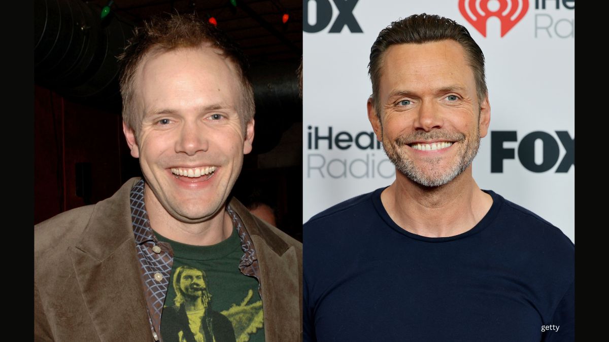 Joel McHale hair transplant